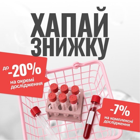 Турбо-бонуси до 20% у Гайсині — акція СМАРТЛАБ